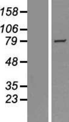 Western Blot: SH2D4A Overexpression Lysate [NBP2-06474]