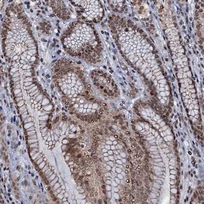 Immunohistochemistry-Paraffin: SH2D4B Antibody [NBP1-90896]