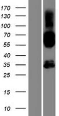 Western Blot: SH2D4B Overexpression Lysate [NBP2-04494]