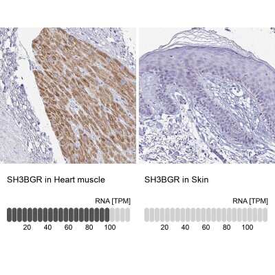 Immunohistochemistry-Paraffin: SH3BGR Antibody [NBP2-38161]