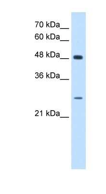 Western Blot: SH3BGR Antibody [NBP1-80550]