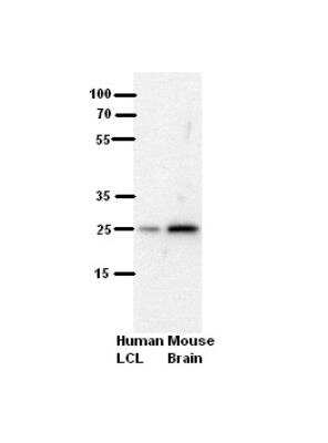 Western Blot: SH3BGR Antibody [NBP1-80550]