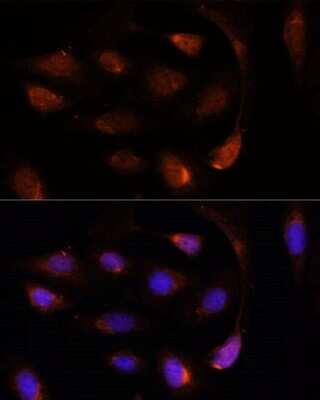 Immunocytochemistry/ Immunofluorescence: SH3BGRL Antibody - Azide and BSA Free [NBP2-93038]