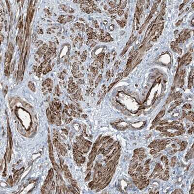 Immunohistochemistry-Paraffin: SH3BGRL3 Antibody [NBP1-89502]