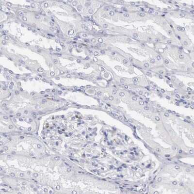 Immunohistochemistry-Paraffin: SH3BP1 Antibody [NBP1-88827]
