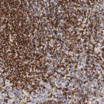 Immunohistochemistry-Paraffin: SH3BP1 Antibody [NBP1-88827]