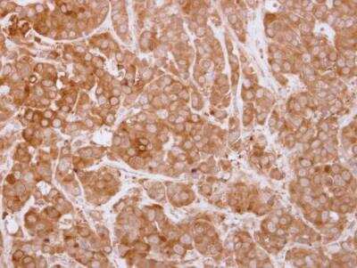 Immunohistochemistry-Paraffin: SH3BP1 Antibody [NBP2-20342]