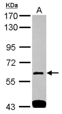 Western Blot: SH3BP1 Antibody [NBP2-20342]