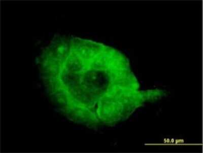Immunocytochemistry/ Immunofluorescence: SH3BP2 Antibody (1E9) [H00006452-M01]