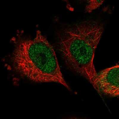 Immunocytochemistry/ Immunofluorescence: SH3BP2 Antibody [NBP1-85458]