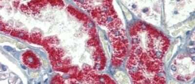 Immunohistochemistry-Paraffin: SH3BP2 Antibody [NBP1-58872]