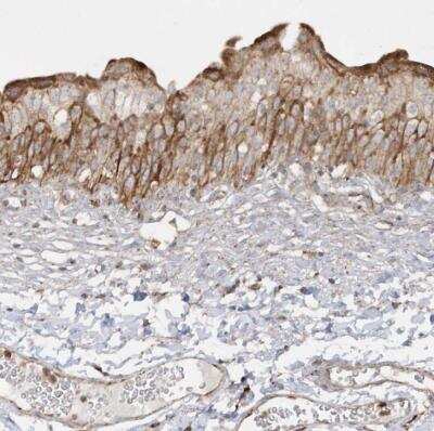 Immunohistochemistry-Paraffin: SH3BP2 Antibody [NBP1-85458]