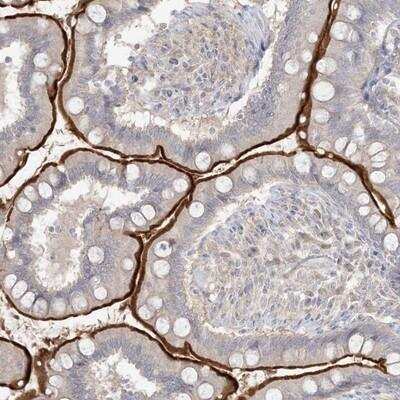 Immunohistochemistry: SH3BP4 Antibody [NBP1-86274]