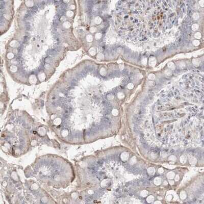 Immunohistochemistry-Paraffin: SH3BP4 Antibody [NBP2-38352]