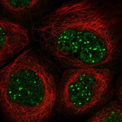 Immunocytochemistry/ Immunofluorescence: SH3BP5 Antibody [NBP1-80796]