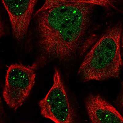 Immunocytochemistry/ Immunofluorescence: SH3BP5 Antibody [NBP2-58311]