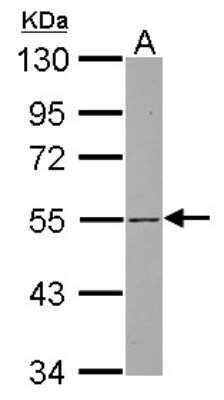 Western Blot: SH3BP5 Antibody [NBP2-20344]