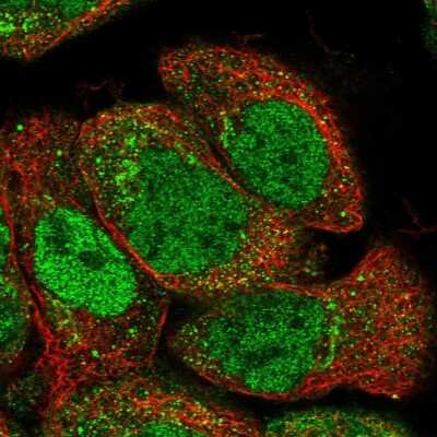 Immunocytochemistry/ Immunofluorescence: SH3BP5L Antibody [NBP1-81381]