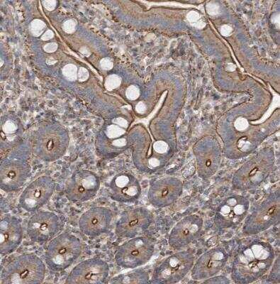 Immunohistochemistry-Paraffin: SH3BP5L Antibody [NBP1-81381]