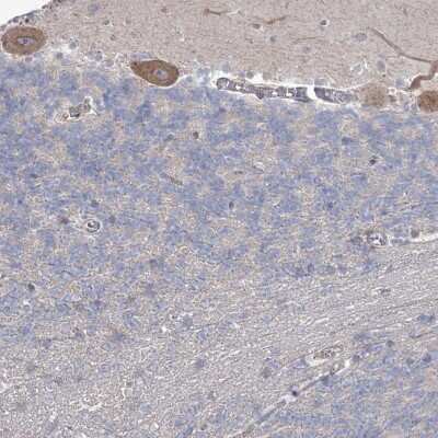 Immunohistochemistry-Paraffin: SH3BP5L Antibody [NBP2-38385]