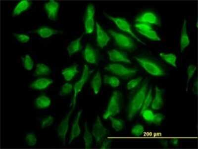 Immunocytochemistry/ Immunofluorescence: SH3D19 Antibody (5C7) [H00152503-M01]