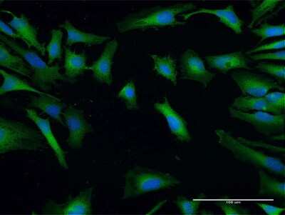 Immunocytochemistry/ Immunofluorescence: SH3GLB2 Antibody [H00056904-B01P]