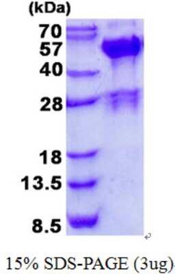 SDS-PAGE: Recombinant Human SH3GLB2 His Protein [NBP2-23468]