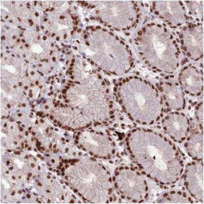 Immunohistochemistry: SH3MD4 Antibody [NBP2-31028]