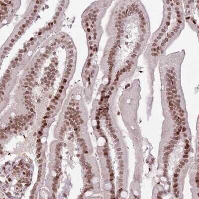 Immunohistochemistry-Paraffin: SH3MD4 Antibody [NBP2-31005]