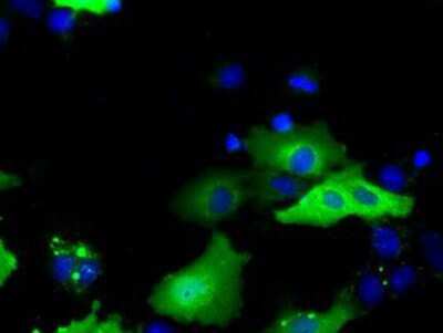Immunocytochemistry/ Immunofluorescence: SH3PX1 Antibody (OTI1B5) [NBP2-02609]