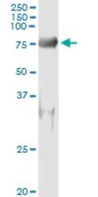 Immunoprecipitation: SH3PX1 Antibody (3C6) [H00051429-M03]