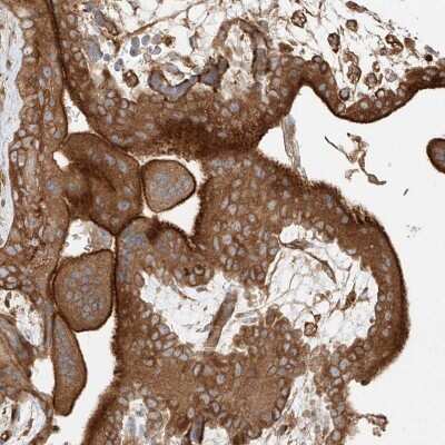 Immunohistochemistry-Paraffin: SH3PX1 Antibody [NBP1-80777]