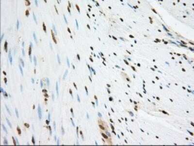 Immunohistochemistry: SH3PX1 Antibody (OTI1B5) - Azide and BSA Free [NBP2-74158]