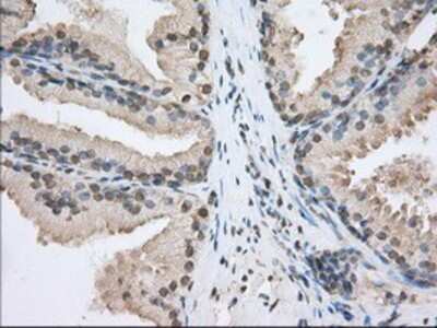Immunohistochemistry: SH3PX1 Antibody (OTI1B5) - Azide and BSA Free [NBP2-74158]