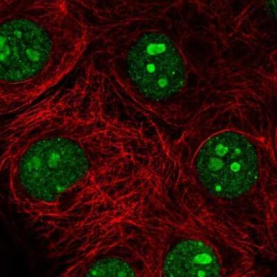 Immunocytochemistry/ Immunofluorescence: SH3TC1 Antibody [NBP2-58624]