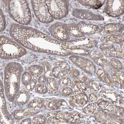 Immunohistochemistry-Paraffin: SH3TC1 Antibody [NBP1-93978]