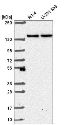 Western Blot: SH3TC1 Antibody [NBP2-58624]