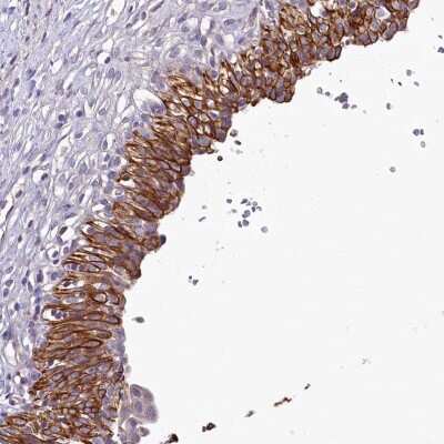 Immunohistochemistry: SH3TC2 Antibody [NBP2-38360]