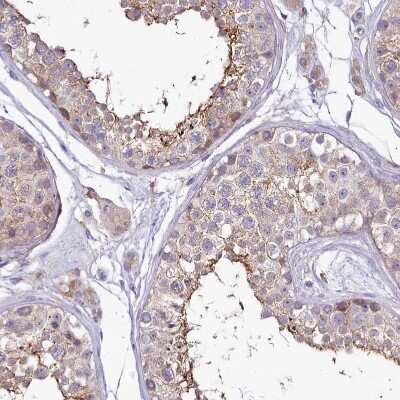 Immunohistochemistry-Paraffin: SH3TC2 Antibody [NBP2-38360]