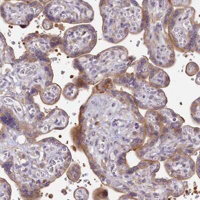 Immunohistochemistry-Paraffin: SH3TC2 Antibody [NBP2-38360]