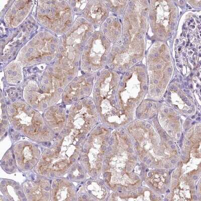 Immunohistochemistry-Paraffin: SH3TC2 Antibody [NBP2-38360]