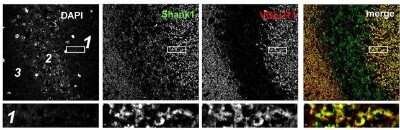 Immunocytochemistry/ Immunofluorescence: SHANK1 Antibody - BSA Free [NB300-167]