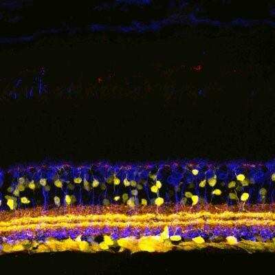 Immunohistochemistry: SHANK1 Antibody - BSA Free [NB300-167]