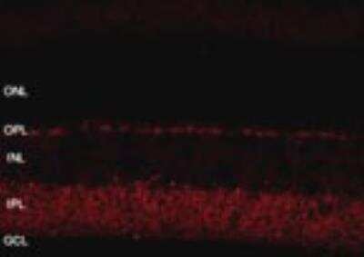 Immunohistochemistry: SHANK1 Antibody - BSA Free [NB300-167]