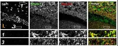 Immunohistochemistry: SHANK1 Antibody - BSA Free [NB300-167]