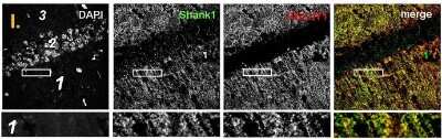 Immunohistochemistry: SHANK1 Antibody - BSA Free [NB300-167]
