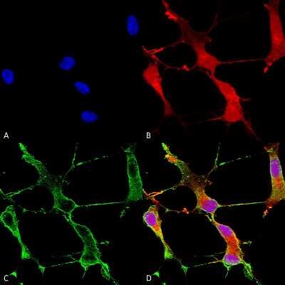 Immunocytochemistry/ Immunofluorescence: SHANK1 Antibody (N22/21) [NBP2-12915]