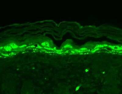 Immunohistochemistry: SHANK1 Antibody (N22/21) [NBP2-12915]