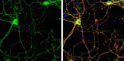Immunocytochemistry/ Immunofluorescence: SHANK2 Antibody [NBP3-13215]