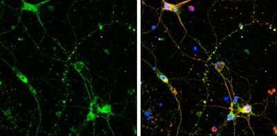 Immunocytochemistry/ Immunofluorescence: SHANK3 Antibody [NBP3-13162]
